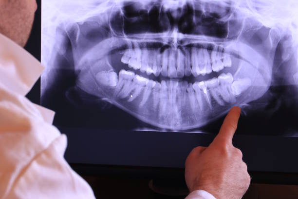 Best Emergency Dentist for Lost Fillings or Crowns in Lenoir City, TN